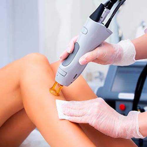 Essentiel Beauté - Epilation LASER Médical Candela- HEADSPA - Massages - Relaxation- - Anti - Age - Soins visage - Ongles — Head Spa — Saint-Dizier